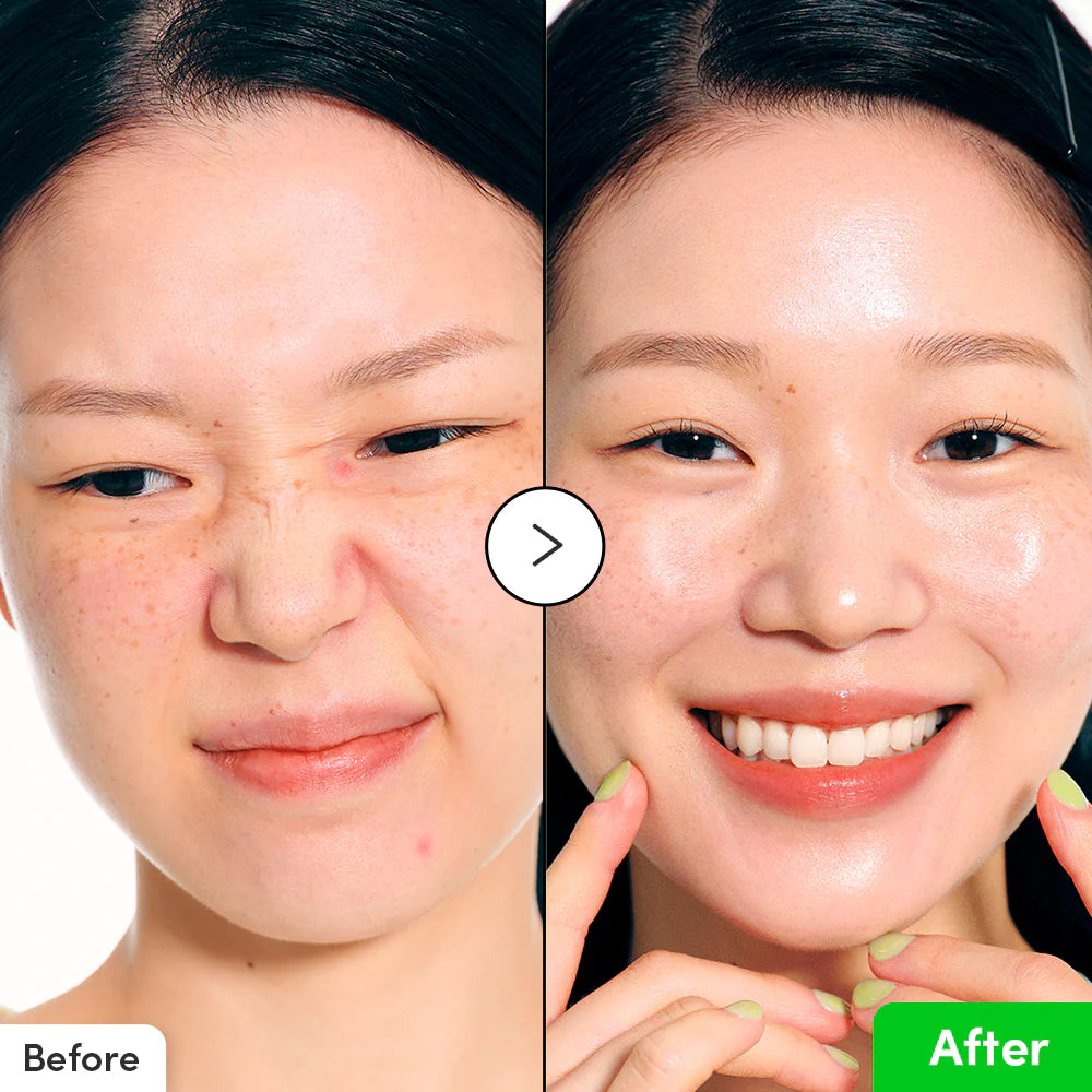 EQQUALBERRY - Aloe PDRN Calming Serum