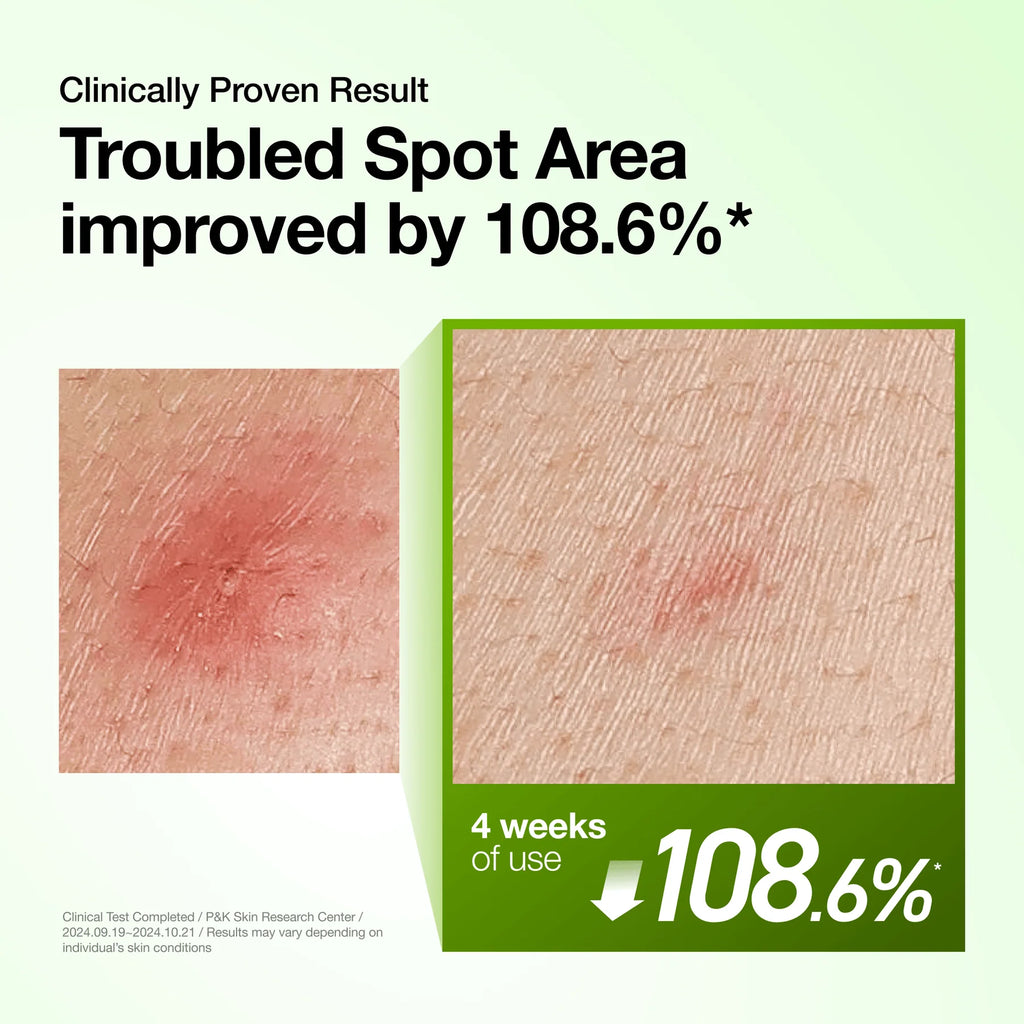 ANUA - Azelaic Acid 10 Hyaluron Redness Soothing Serum