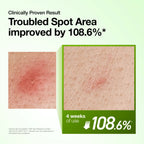 ANUA - Azelaic Acid 10 Hyaluron Redness Soothing Serum