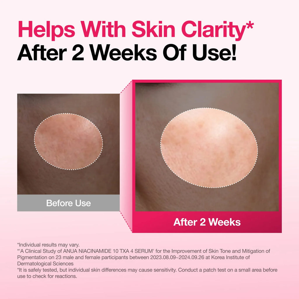ANUA - Niacinamide 10+ TXA 4 Serum